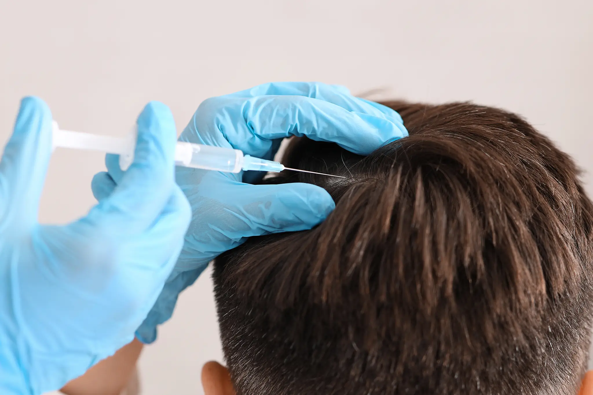 Injection treatment for hair restoration